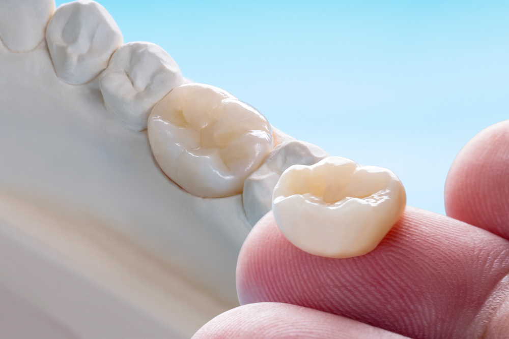 Custom-milled same-day crown being placed onto a model tooth at Page Family Dentistry